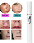 Blue Light Therapy Acne Laser Pen
