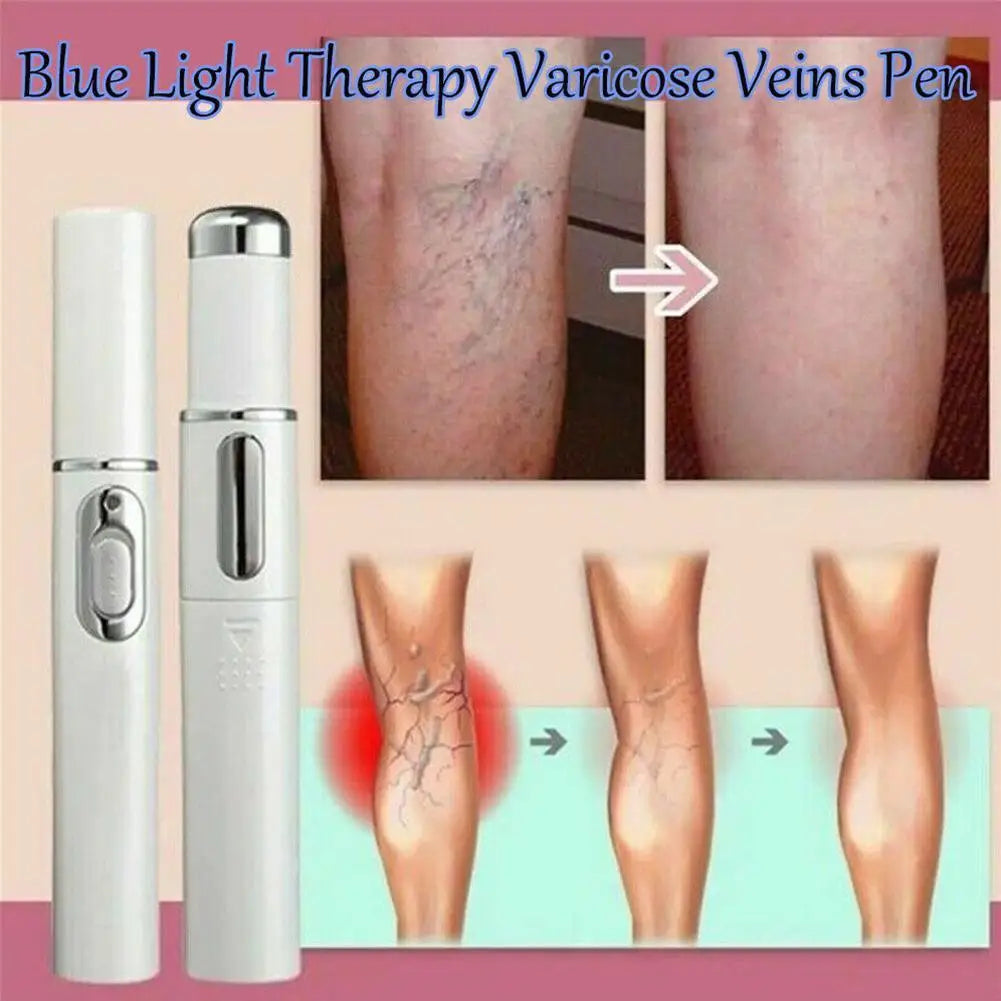 Blue Light Therapy Acne Laser Pen