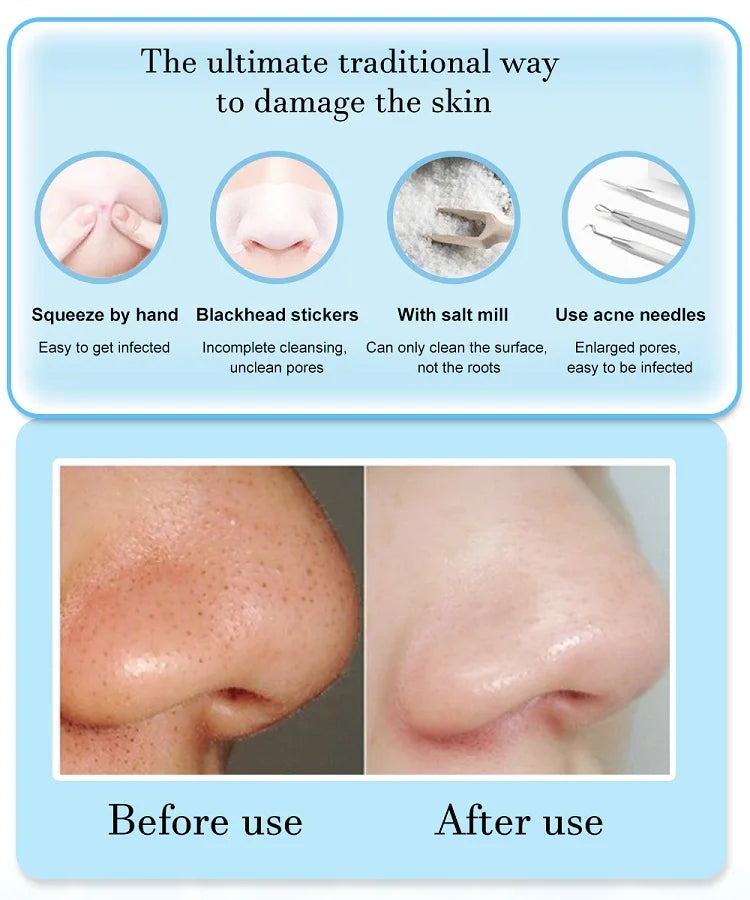 3 Suction Mode Face Cleansing Beauty Machine